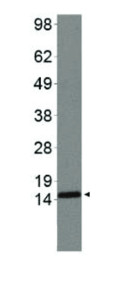 western blot using anti-H3R2me2(sym)K4me2 | Histone H3 (sym-dimethylated Arg2, dimethyl Lys4) polyclonal antibodies