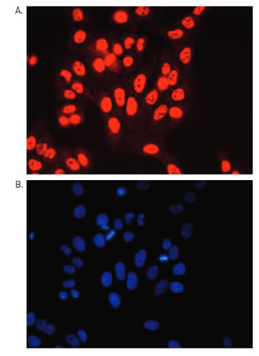 immunofluorescence using anti-H3K4me3 | histone H3, trimethylated lysine 4 (H3K4me3) polyclonal antibodies