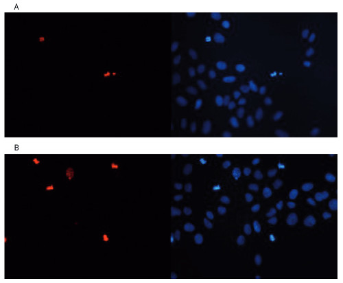 Immunofluorescence using anti-H3S10p | Histone H3 (p Ser10) polyclonal antibodies