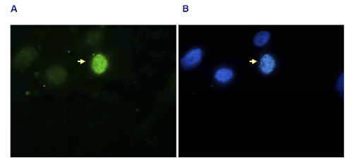Immunofluorescence using anti-H3S10p | Histone H3 (p Ser10) (serum)