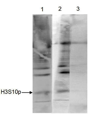 Immunoprecipitation using anti-H3S10p | Histone H3 (p Ser10) (serum) antibodies