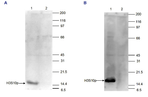 western blot using anti-H3S10p | Histone H3 (p Ser10) (serum) ani