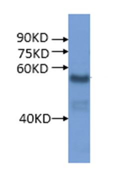 western blot using anti-rice ATPase subunit B antibodies