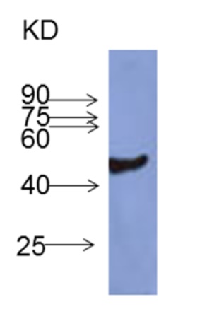 western blot using anti-FBA, cytoplasmic aldolase antibodies