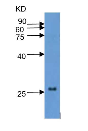 western blot using anti-WRKY10 antibodies