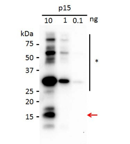 western blot using anti-p15 [Peanut clump virus] antibodies