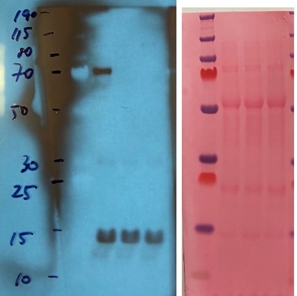 Western blot using anti-CRY2 antiodies