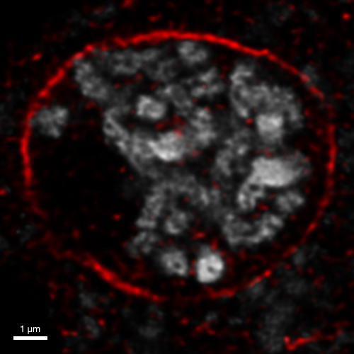 Immunofluorescent localization of plant SUN1,2