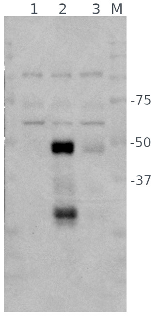 Western blot using anti-ABI5 antibodies'