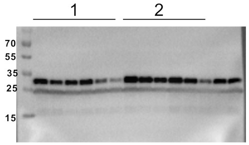 Western blot using anti-RPS6A-P237 antibodies