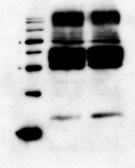 Western blot using anti-LHCR4 antibodies