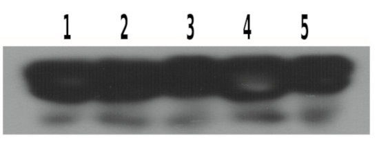 Western blot using anti-eIF2 antibodies