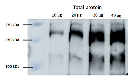Western blot using anti-RPB2 antibodies