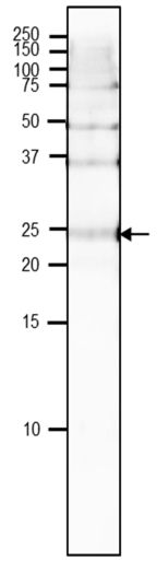 Western blot using anti-VPS29 antibodies