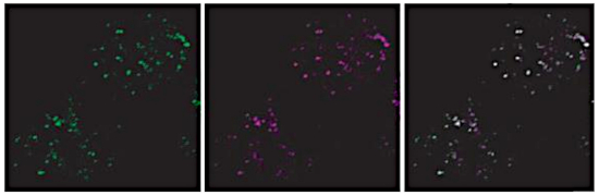 Immunofluorescence using anti-VPS35 antibodies