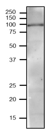 Western blot with anti-VPS35 antibodies