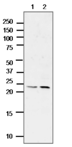 Western blot using anti-ALEU antibodies