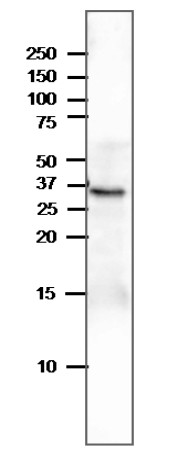 Western blot using anti-Delta VPE antibodies