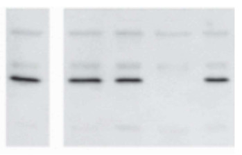 Western blot using anti-OLE1 antibodies