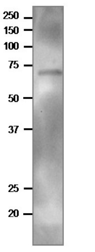 Western blot using anti-TGG2 antibodies