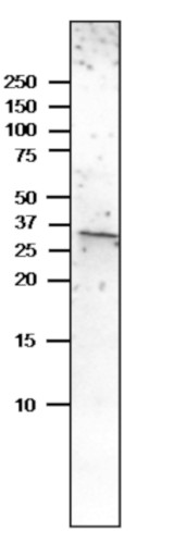 Western blot using anti-Caleosin antibodies