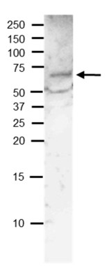 Western blot using anti-BG1 antibodies