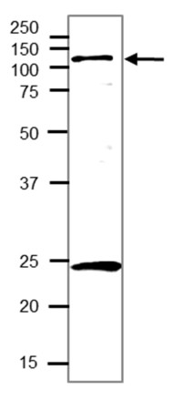 Western blot using anti-NAI2 antibodies