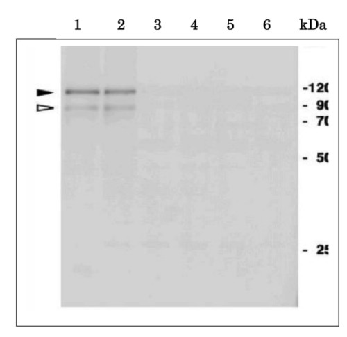 Western blot using anti-NAI2 antibodies