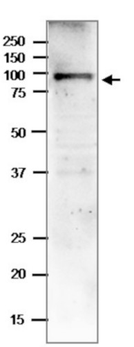 Western blot using anti-MEB1 antibodies