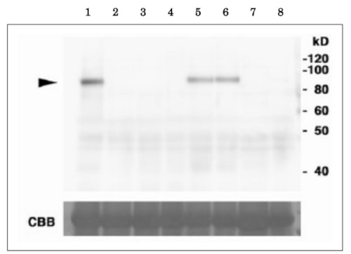 Western blot using anti-MEB1 antibodies