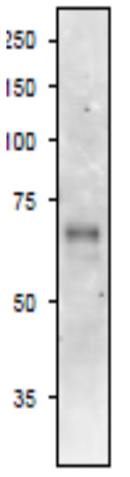 Western blot using anti-ASN Glutamine-dependent asparagine synthetase