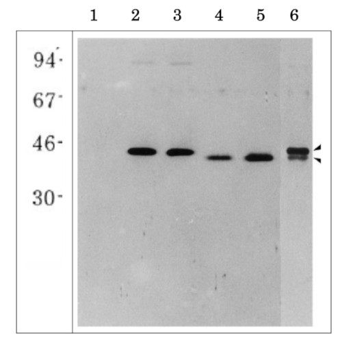 Western blot with anti-Glutamine synthetase antibodies