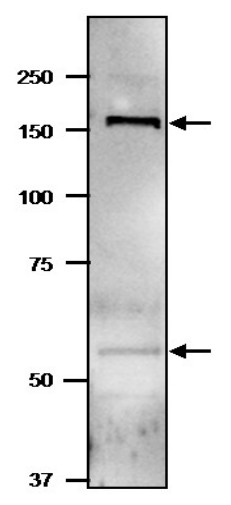Western blot using anti-NADPH-dependent glutamate synthase (GltBD)
