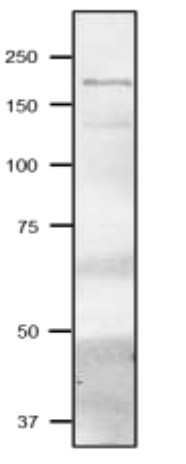 Western blot using anti-FdGOGAT antibodies on cyanobacterial extract