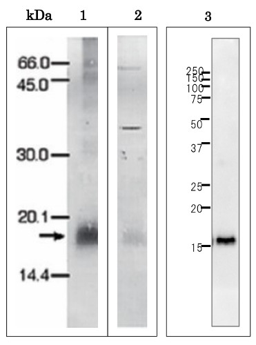 Western blot using anti-Plasmodium falciparum ferredoxin