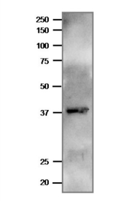 Western blot using anti-FNR antibodies (Plasmodium falciparum)