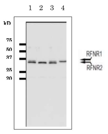 Western blot using anti-root FNR antibodies