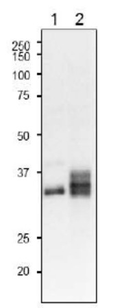 Western blot using anti-FNR3 antibodies