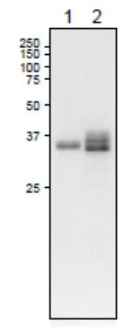 Western blot using anti-FNR1 antibodies