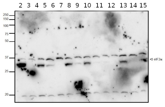 Western blot using anti-eIF2 alpha, phosphorylated antibodies