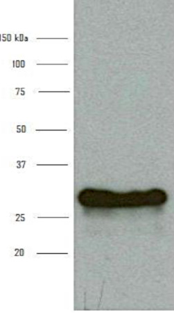 Western blot using anti-BFP,GFP, YFP antibodies