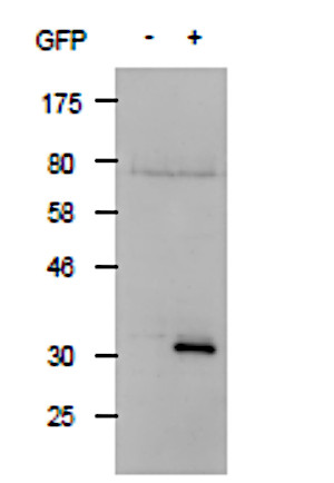 Western blot using anti-GFP antibodies