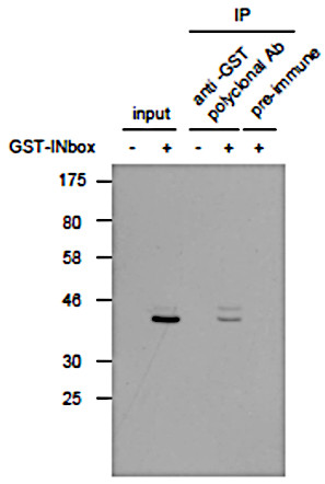 Immunoprecipiation and Western blot with anti-GST tag antibodies