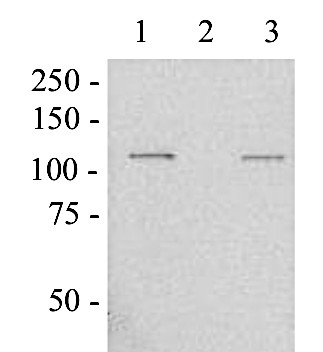 Western blot using anti-beta galactosidase antibodies