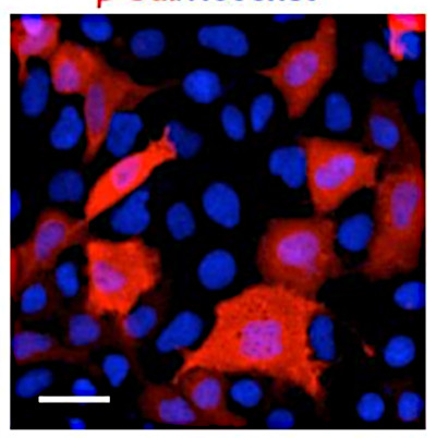 Immunofluorescence using anti-GAL antibodies