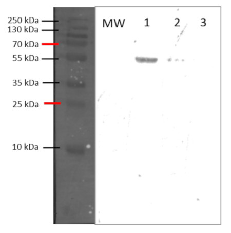 Western Blot using anti-Plant Catalase 2 antibodies