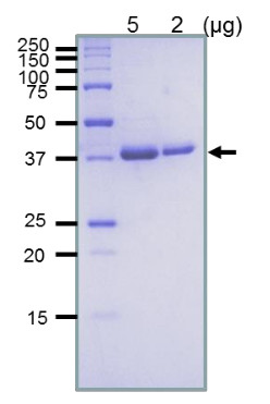 RuvB (E.coli) positive control