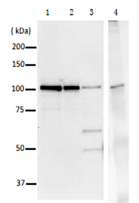 Immunoprecipitation using anti-polymerase I antibodies