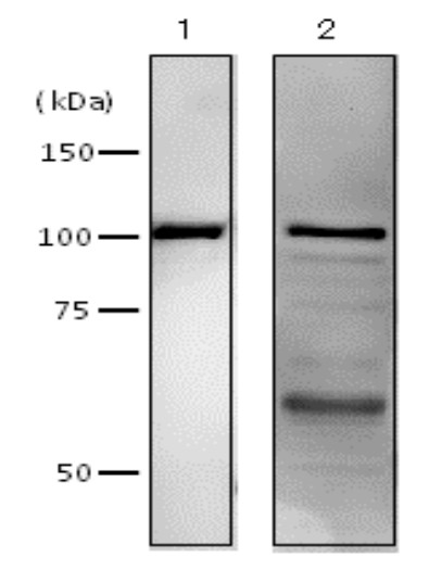 Western blot using anti-DNA polymerase I antibodies 