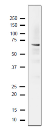 Western blot using anti-Rfa1 (yeast) antibodies